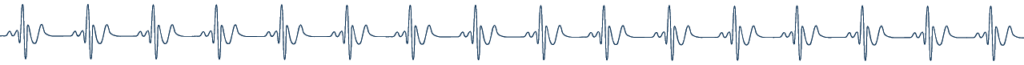 Illustration of an EKG chart.