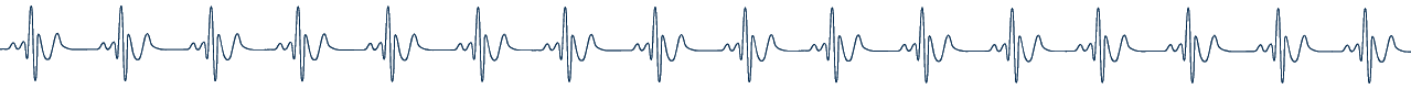 Illustration of an EKG chart.