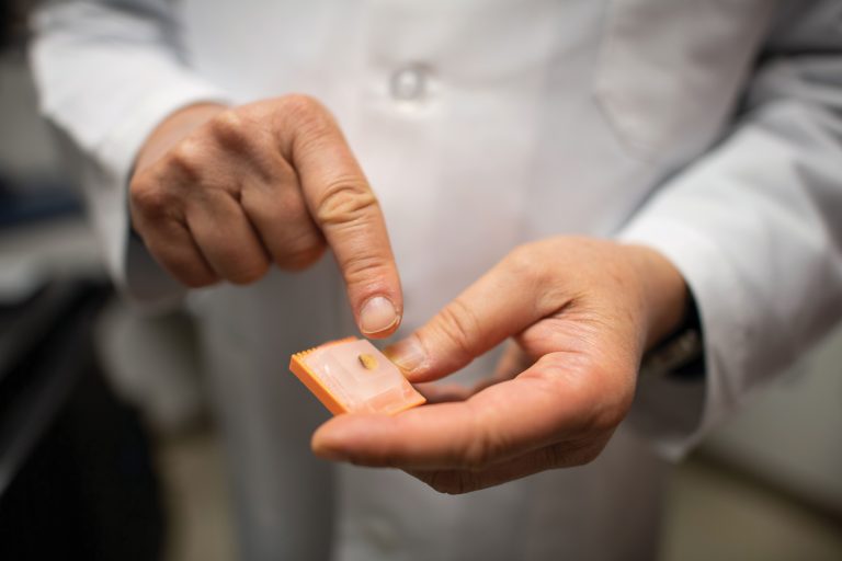 A medical slide with tumor samples.