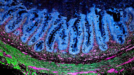 Microscopic tissue section with vivid blue, green, and pink cellular structures.