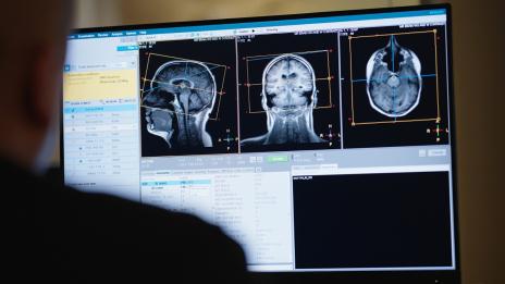 A person sits in front of a widescreen monitor in a dark room, analyzing medical imaging software. The screen features a three-panel display showing sagittal, coronal, and axial MRI views of a brain, surrounded by technical data and scan settings.