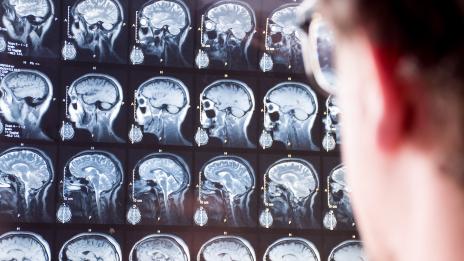 A person is looking at a display of multiple MRI brain scan images.