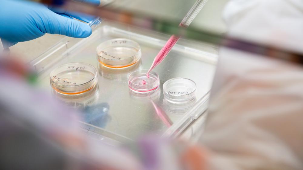 Up close of liquid being placed into a small petri dish