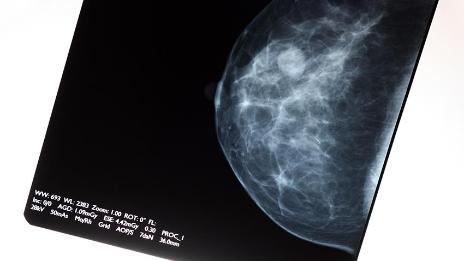 Susie Schwartz Howard Breast Cancer Endowed Research Fund - 799437